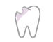 歯の欠損