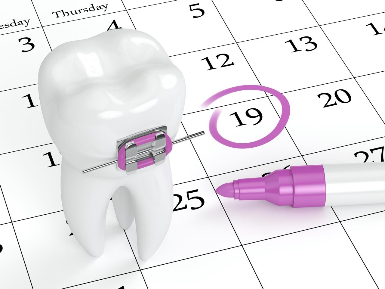 歯列矯正の調整は何をするの？頻度・期間・調整料についても解説